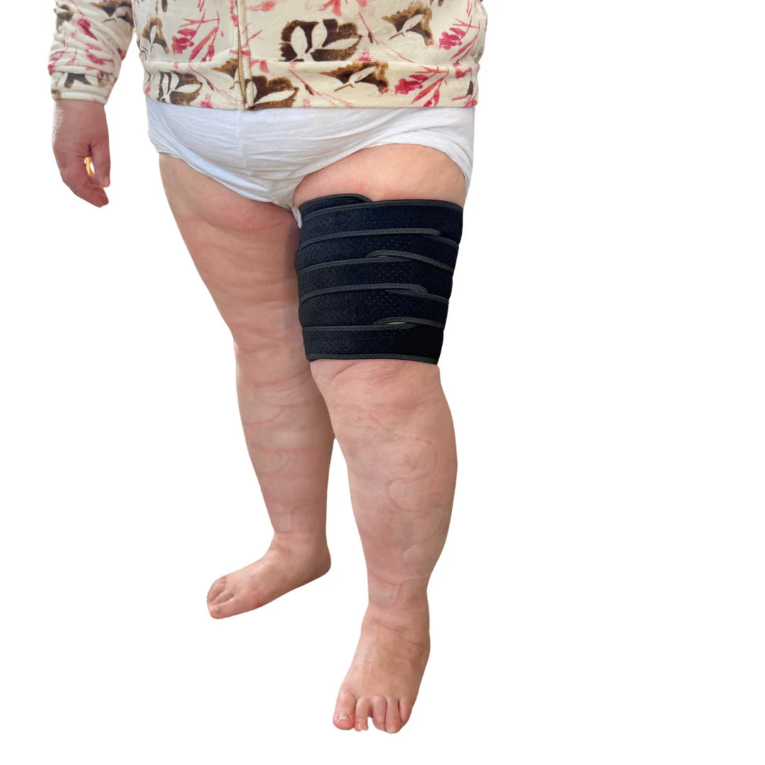 Calmleg-kompressionsbandage för svullna lår - Calmleg